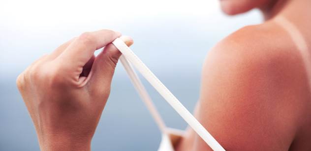 ČPZP podporuje prevenci rakoviny kůže, v létě si ale dejte pozor i na další rizika